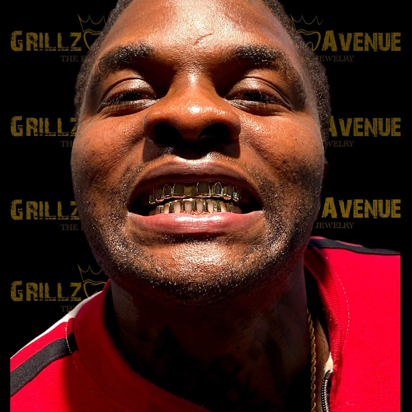 Custom Grillz Rose Cuts and Diamond Dust 10k Yellow Gold