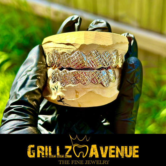 Custom Grillz Diamond Cuts and Diamond Dust 10k Yellow Gold