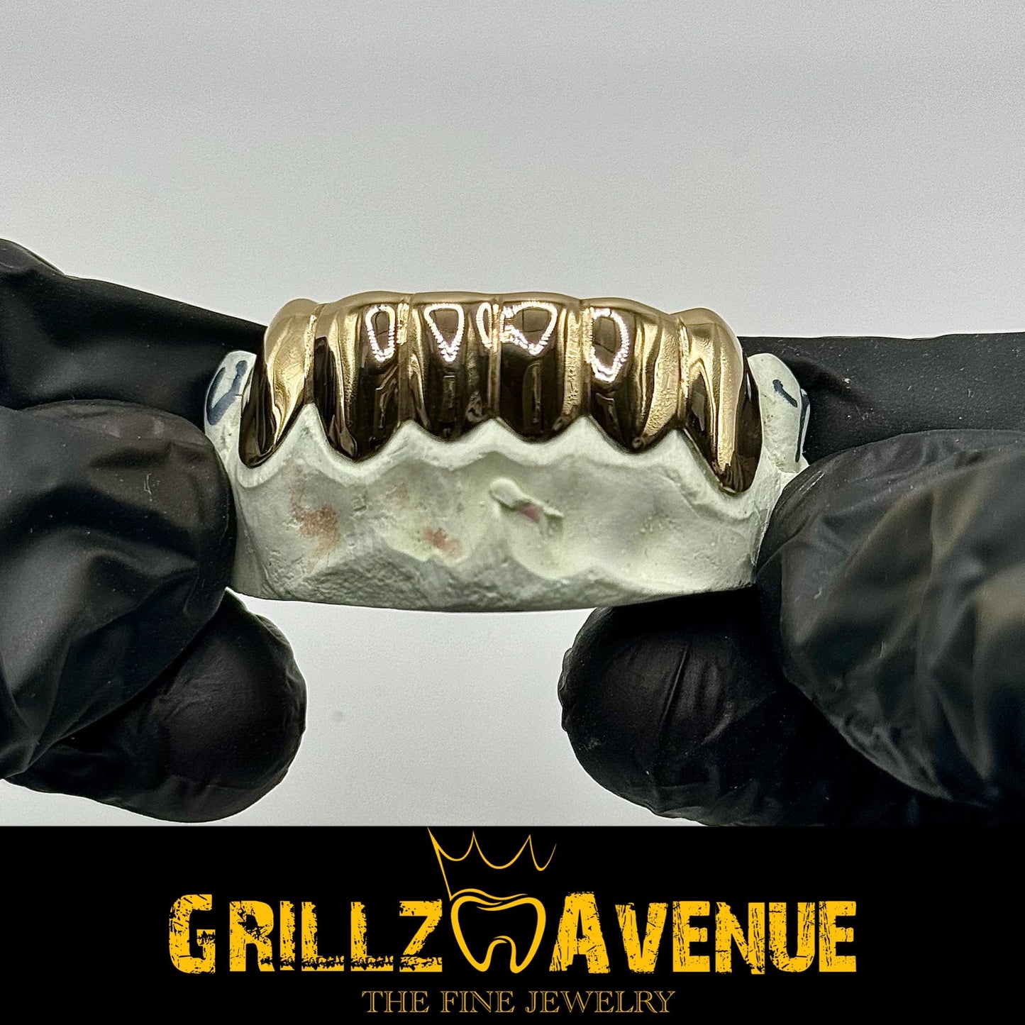 Custom Grillz Solid Gold