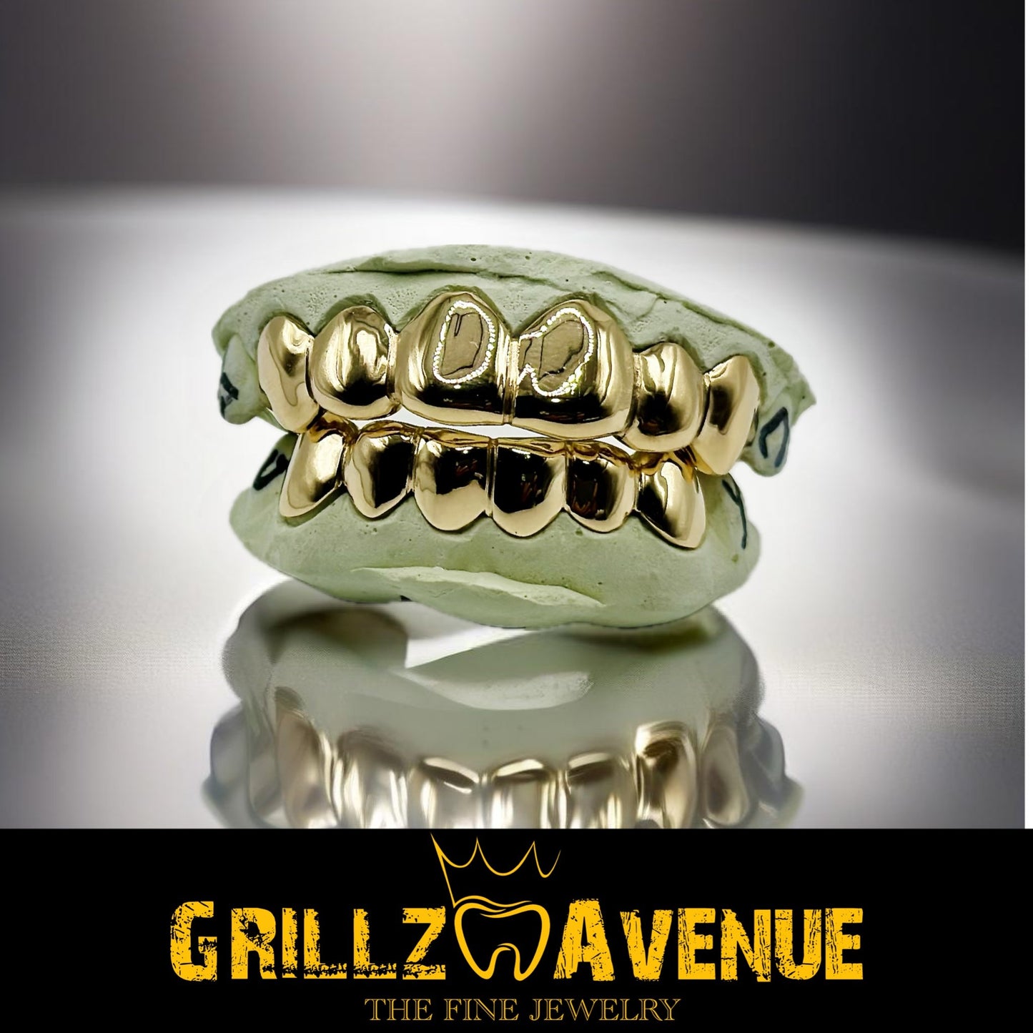 Custom Grillz Solid Gold