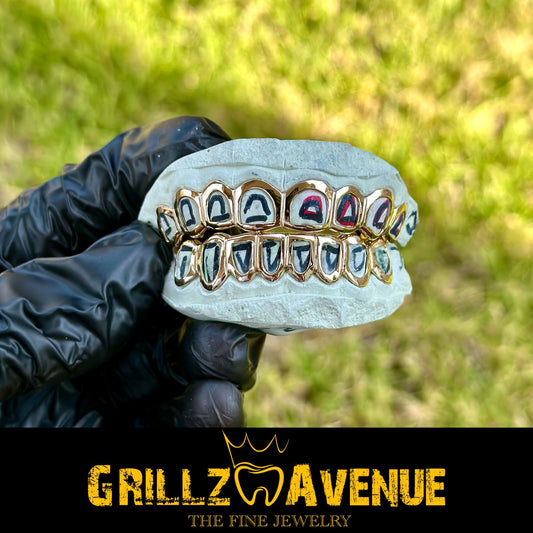 Custom Grillz Open Face Style 10k Yellow Gold