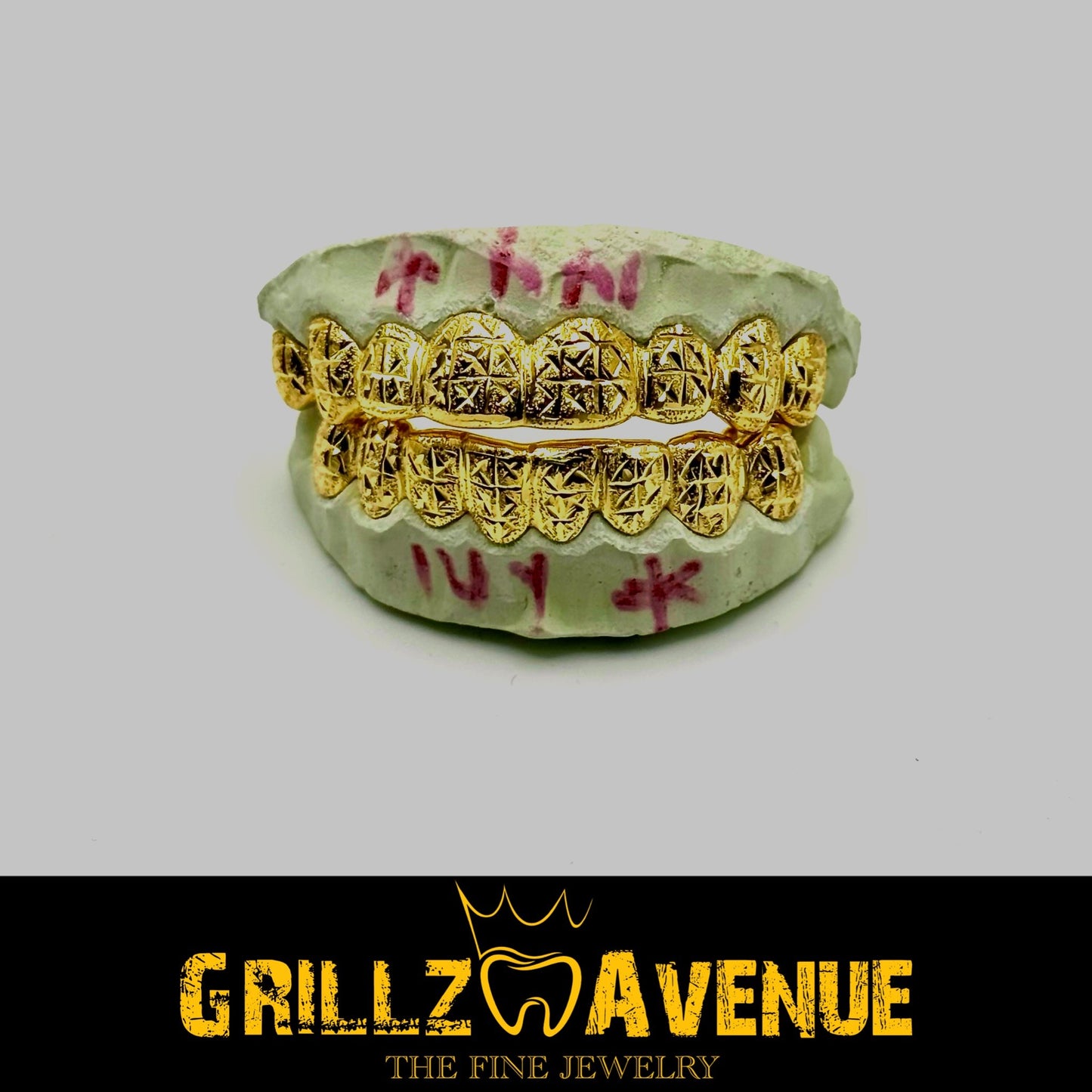 Custom Grillz Pineapple Cuts and Diamond Dust 10k Yellow Gold