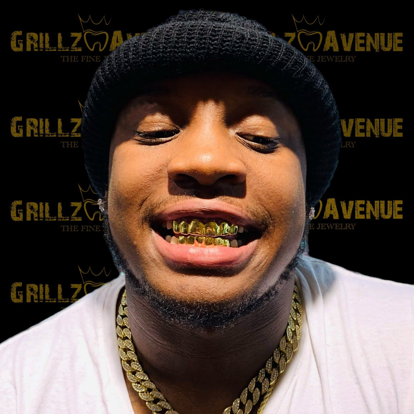 Custom Grillz Solid Gold