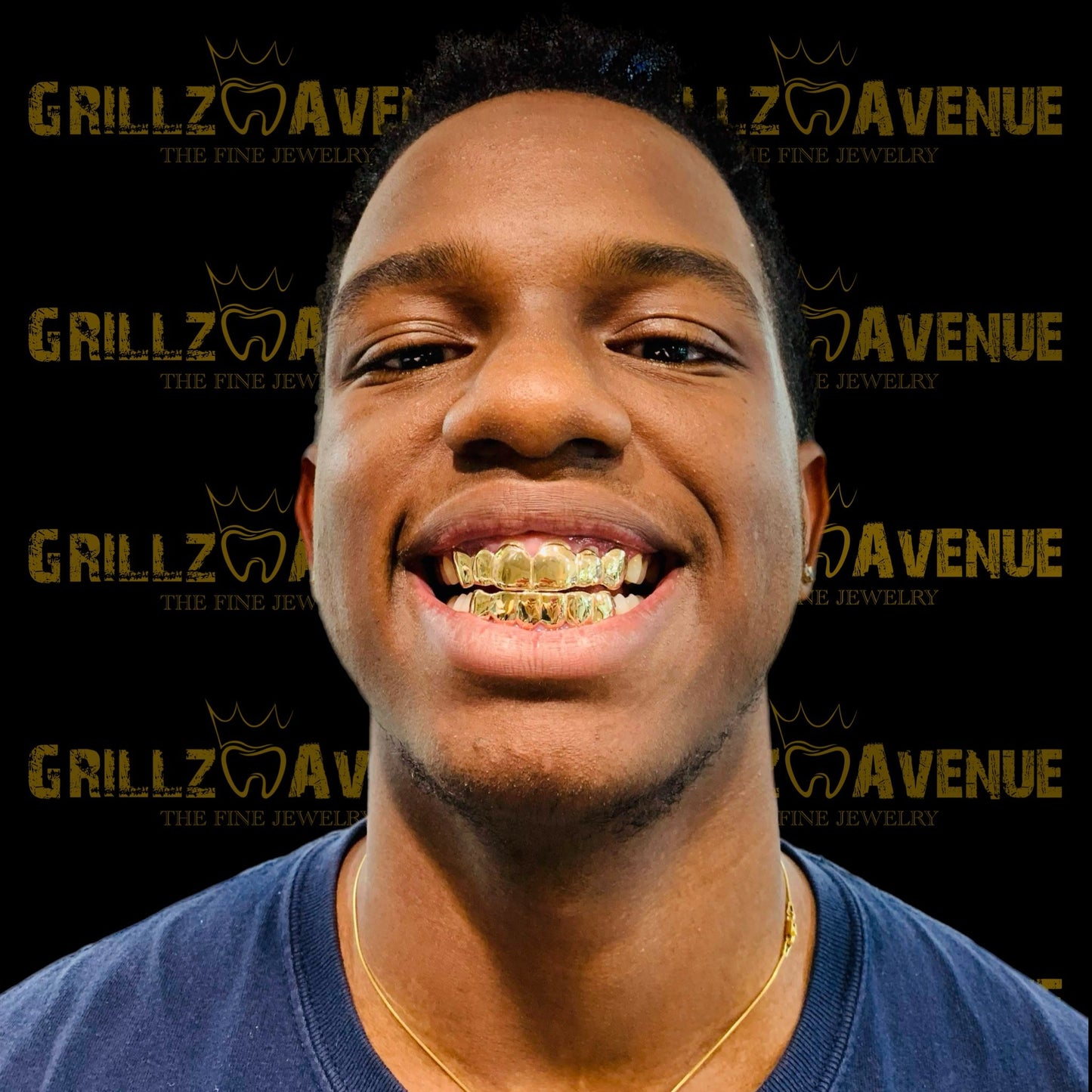 Custom Grillz Solid Gold