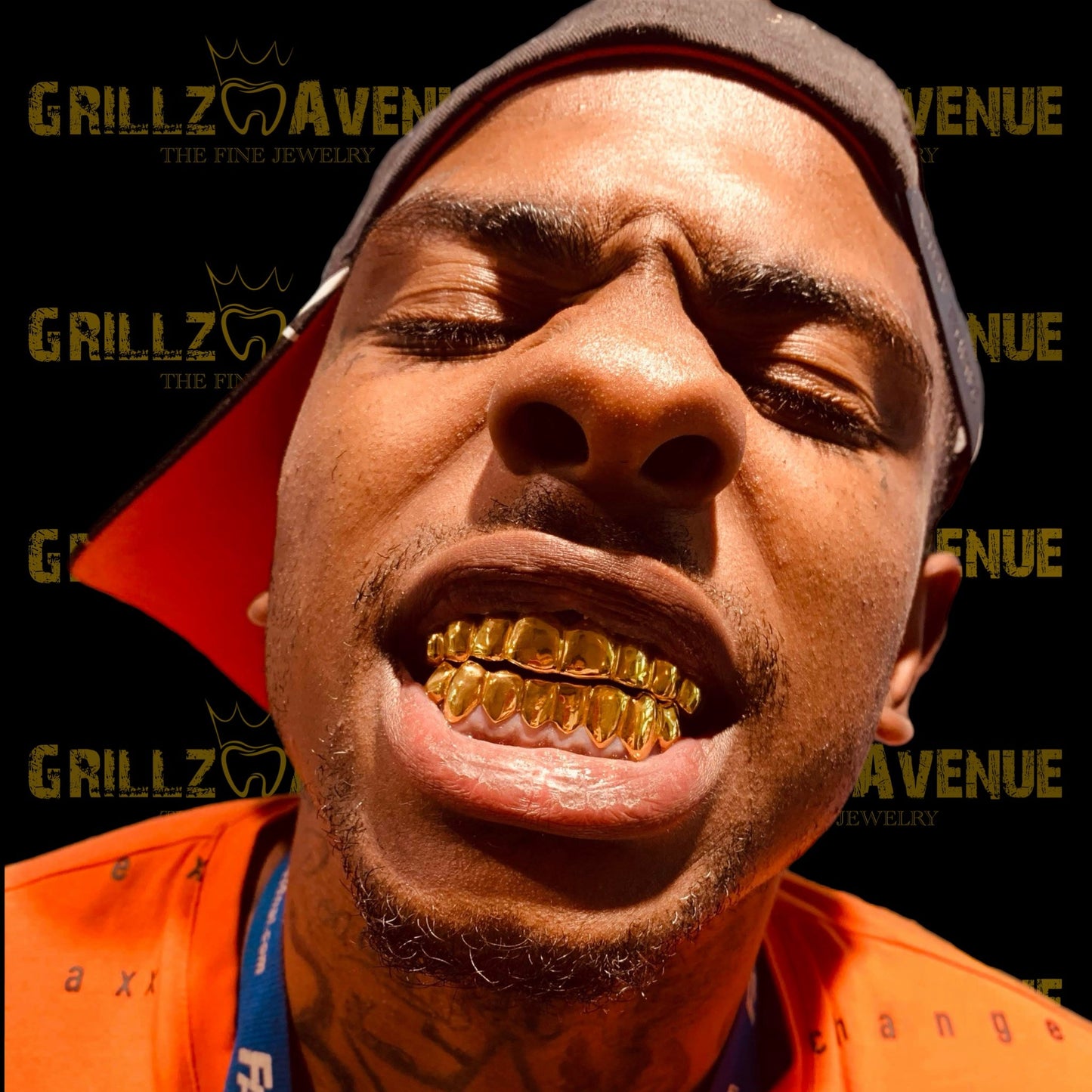 Custom Grillz Solid Gold