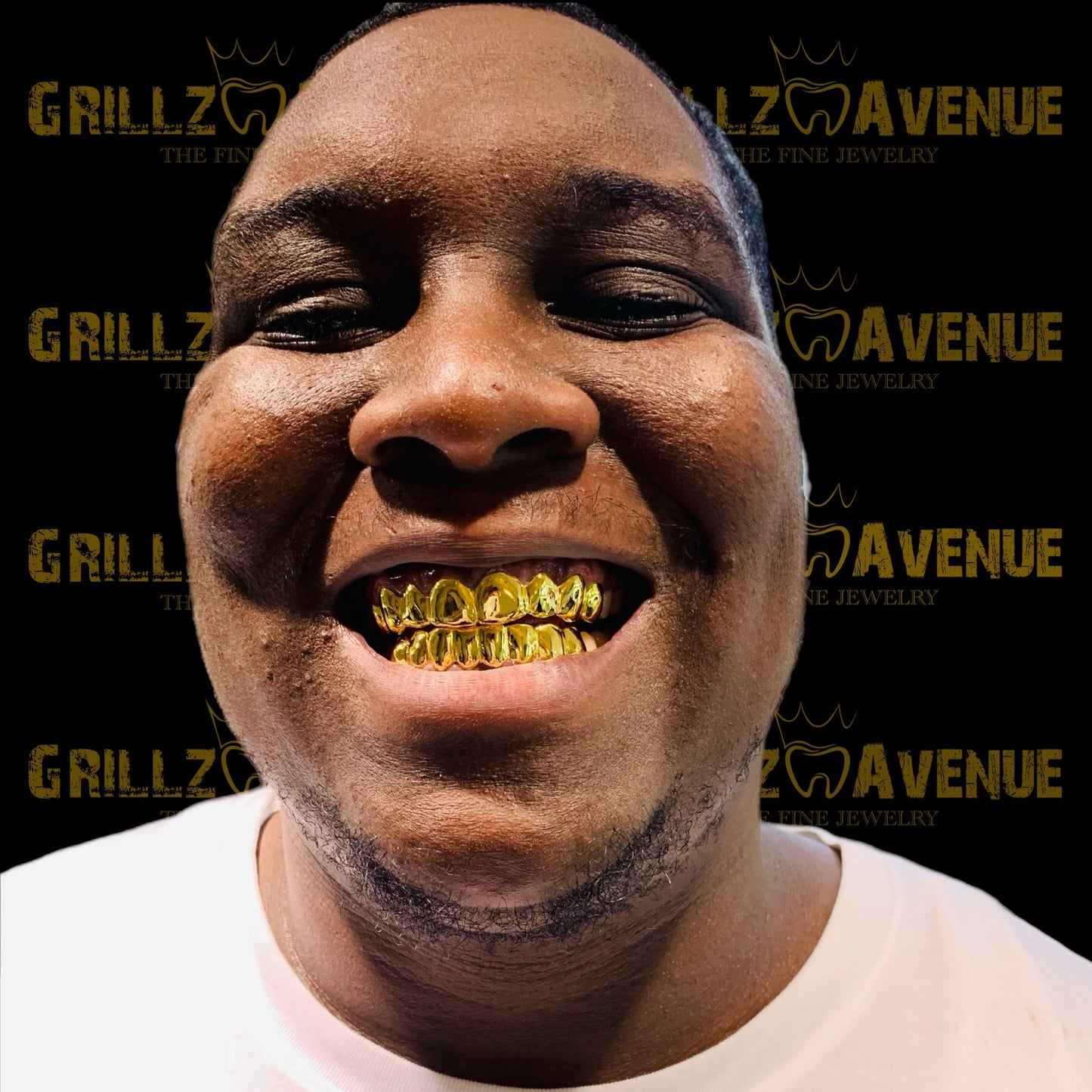 Custom Grillz Solid Gold