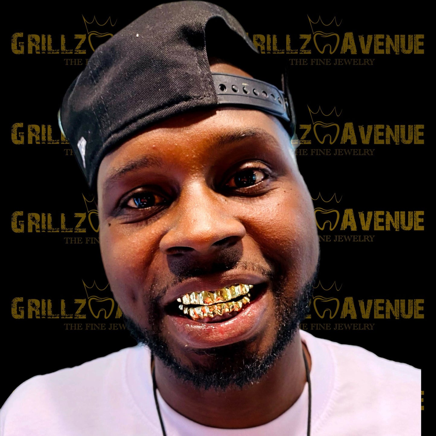 Custom Grillz Solid Gold