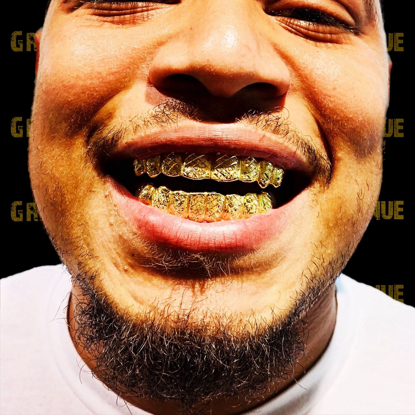 Custom Grillz Diamond Cuts and Diamond Dust 10k Yellow Gold